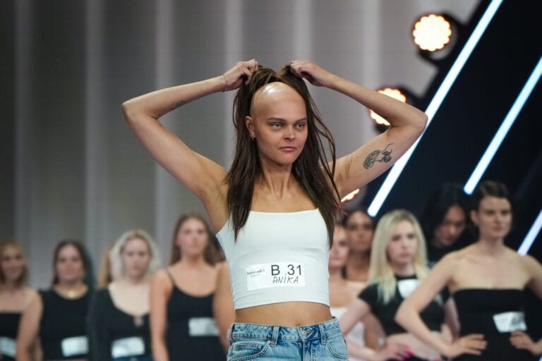 GNTM 2026 Anika im Interview: „Mein Traum, mich als Model ohne Haare zu zeigen, ist wahr geworden“