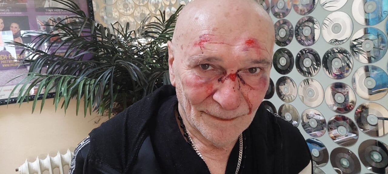 Schlagersänger zusammengeschlagen und brutal überfallen! Schlagersänger zusammengeschlagen und brutal überfallen!